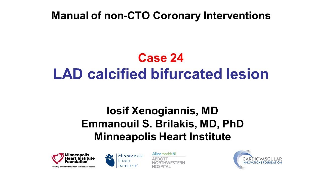 Case 24: PCI Manual: LAD calcified bifurcation lesion