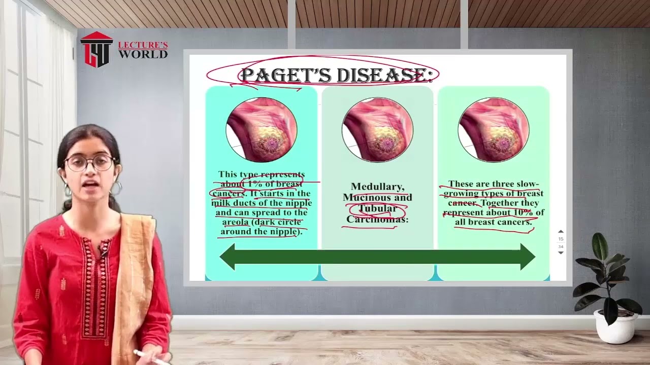 Post Basic 1st Year - Medical Surgical Nursing - Introduction To Oncology -  Breast Cancer