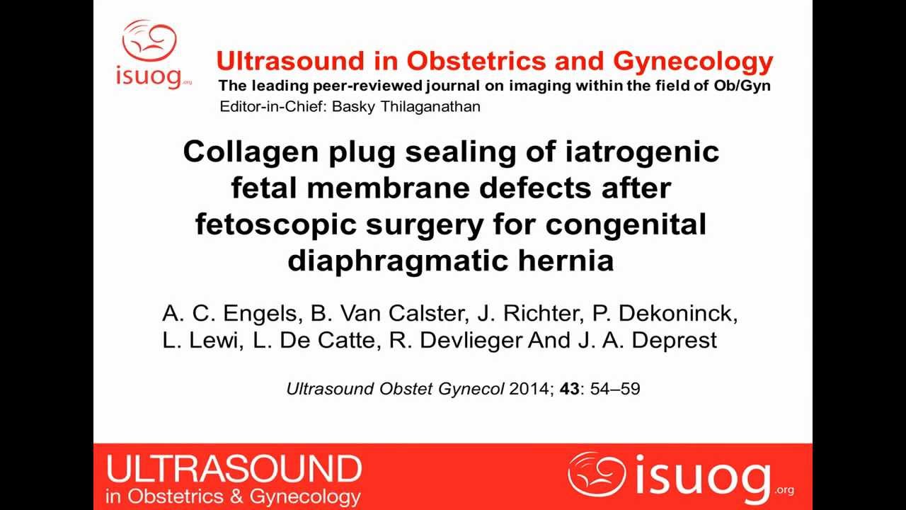 Collagen plug placement after fetoscopic surgery