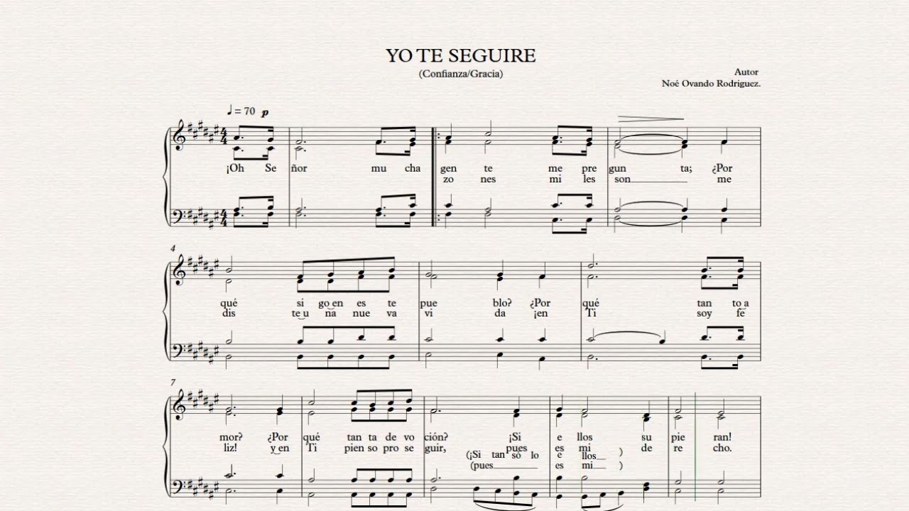 YO TE SEGUIRE ENSAMBLE