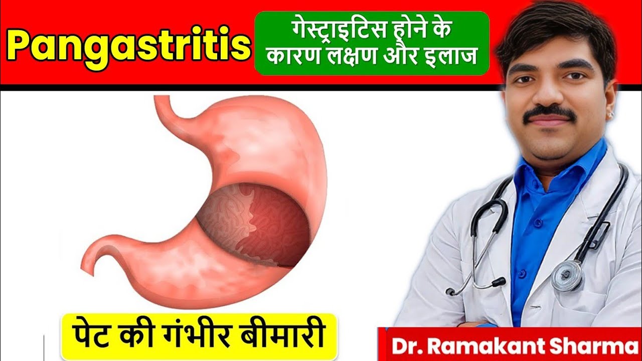 Pangastritis: Types, Causes, Symptoms, Complications, and Treatment @dr.ramakantsharma7