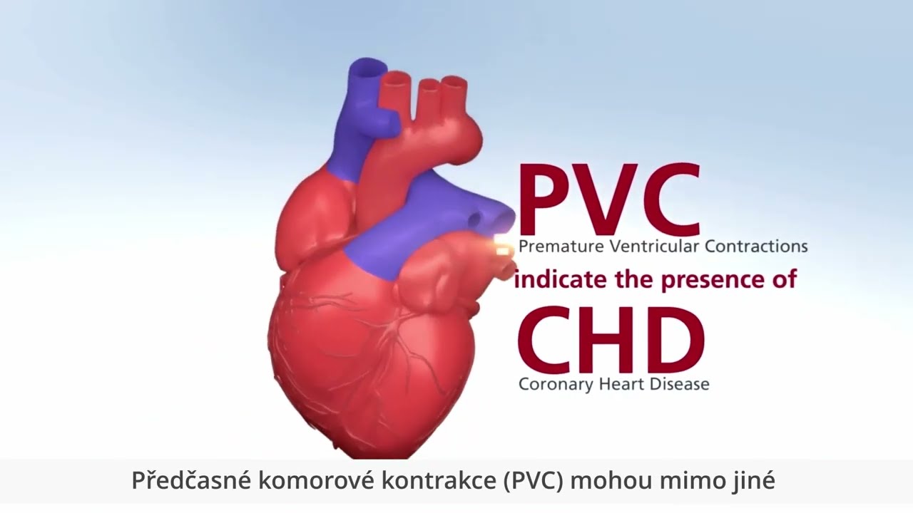 Co jsou předčasné srdeční kontrakce? | Rossmax