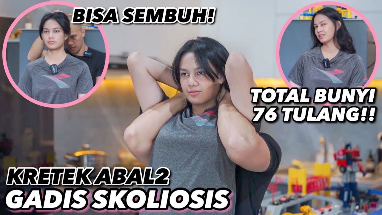 KRETEK ABAL2 GADIS SKOLIOSIS, TULANGNYA BISA LURUS LAGI!