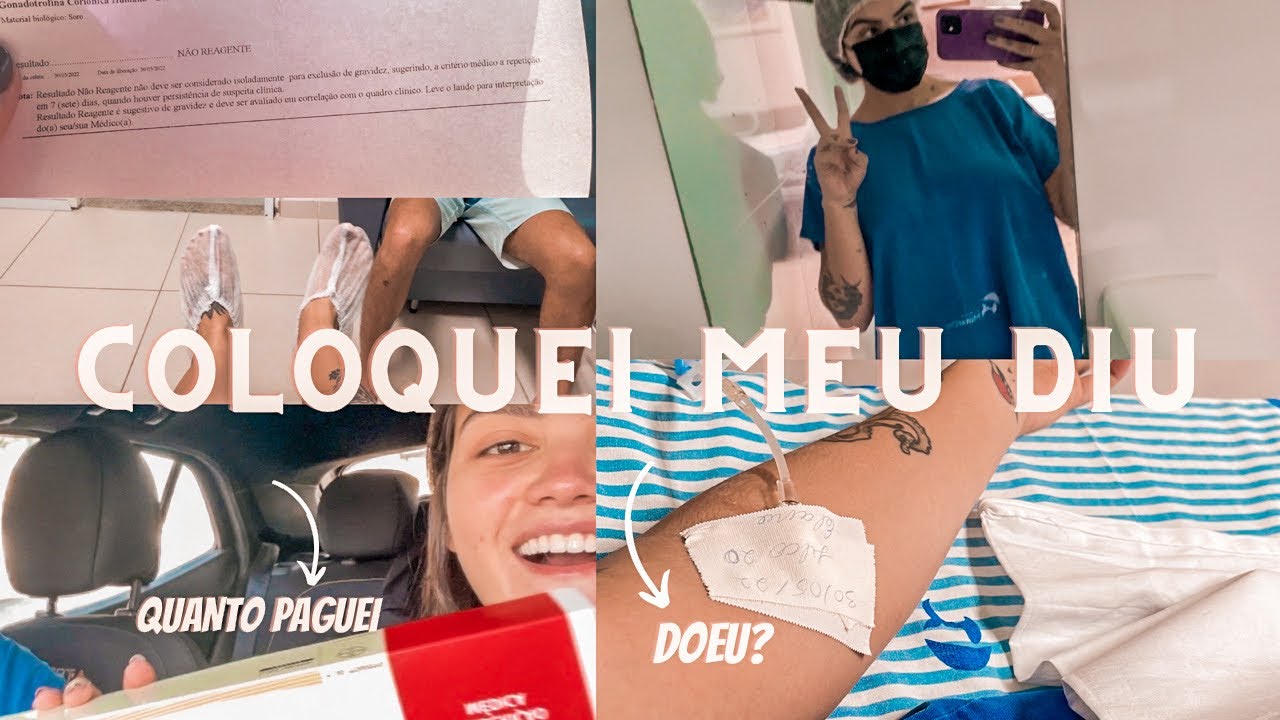 #vlog coloquei DIU Kyleena doeu? quanto paguei? consult&oacute;rio ou internei? ATUALIZADO 2022