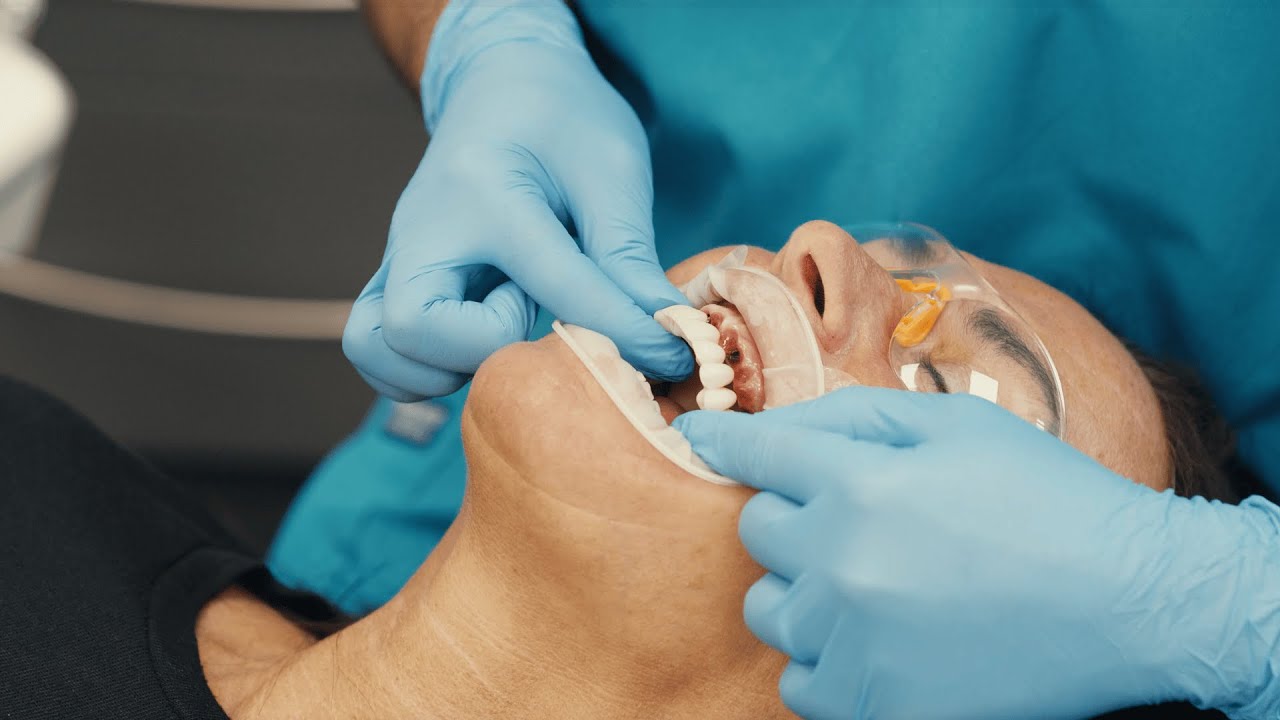 What Are Same Day Teeth - Straumann Dental Implants