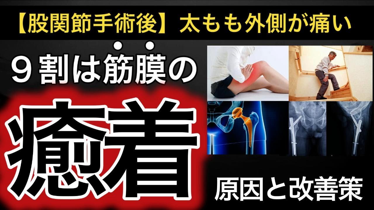 【股関節手術後】太もも外側が痛む理由と改善方法（人工股関節/大腿骨転子部骨折/歩く・階段で痛い）