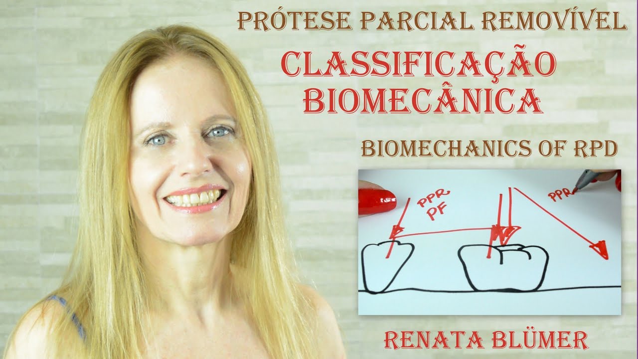 🙋‍♀️CLASSIFICAÇÃO BIOMECÂNICA - PRÓTESE PARCIAL REMOVÍVEL   #planejamentoppr