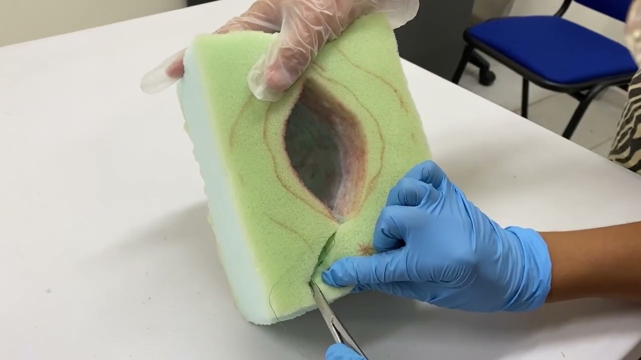 PROCEDIMIENTO DE INFILTRACIÓN EPISIOTOMÍA Y EPISIORRAFIA