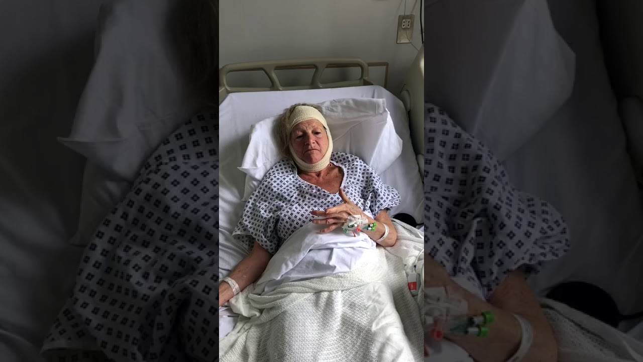 Alison, 1 day post jaw joint (TMJ) replacement