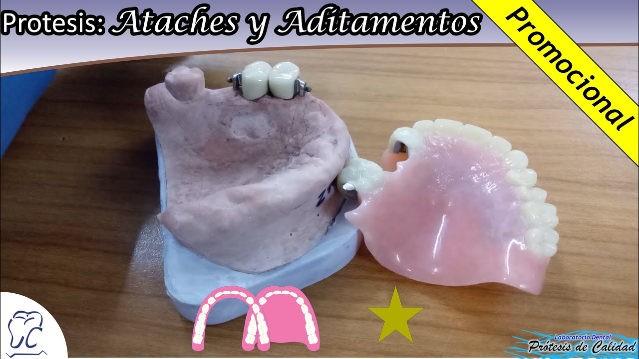 Prótesis: Ataches y Aditamentos 08