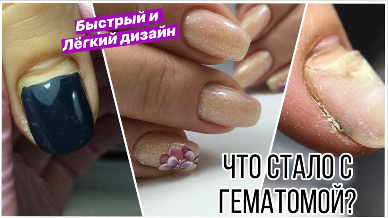 Гематома//Исправлять или оставить?/ Перламутровая база от Cosmake