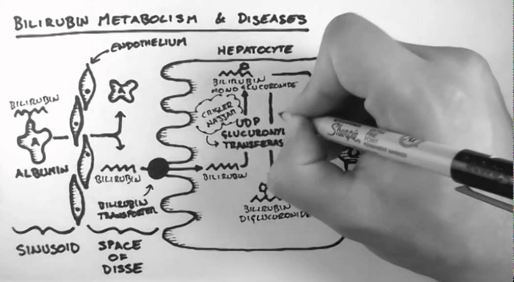 Bilirubin 2 - Bilirubin Metabolism & Diseases