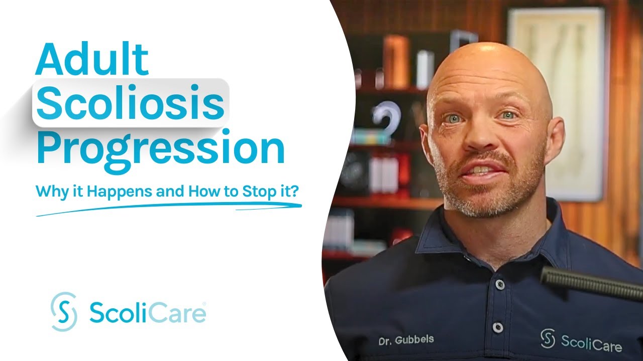 How to Stop Adult Scoliosis Progression Naturally | Proven Non-Surgical Solutions