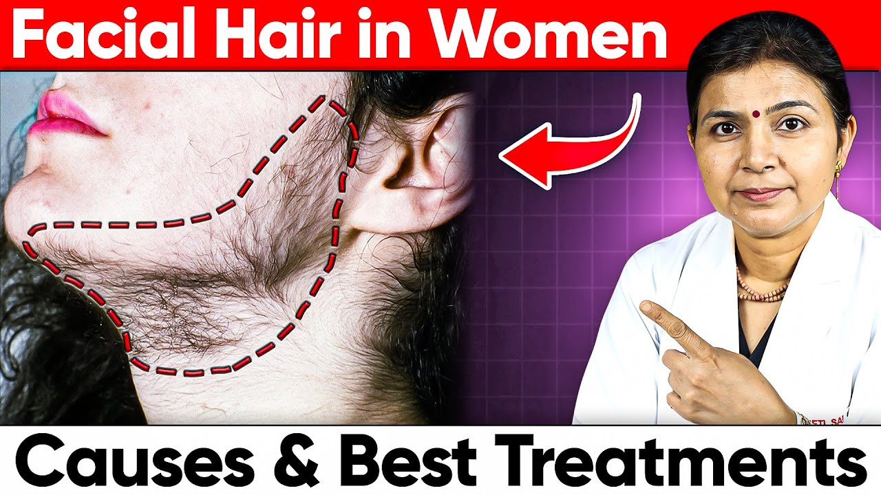 Facial Hair in Women: Causes & Best Hair Removal Methods & Permanent Solutions Explained