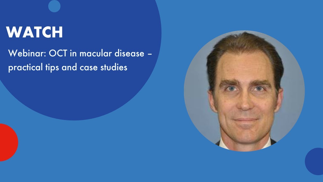 Webinar: OCT in macular disease - practical tips and case studies