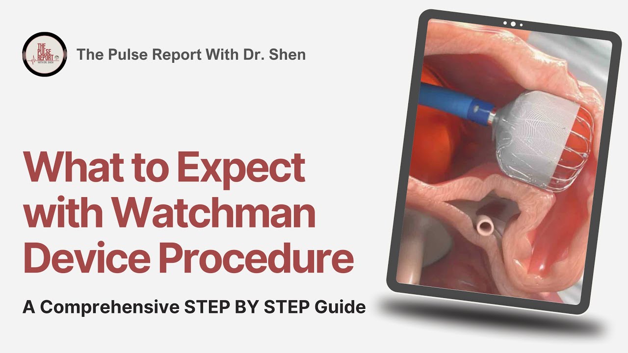 Watchman Device Guide for Patients: What to Expect Before, During & After the Procedure