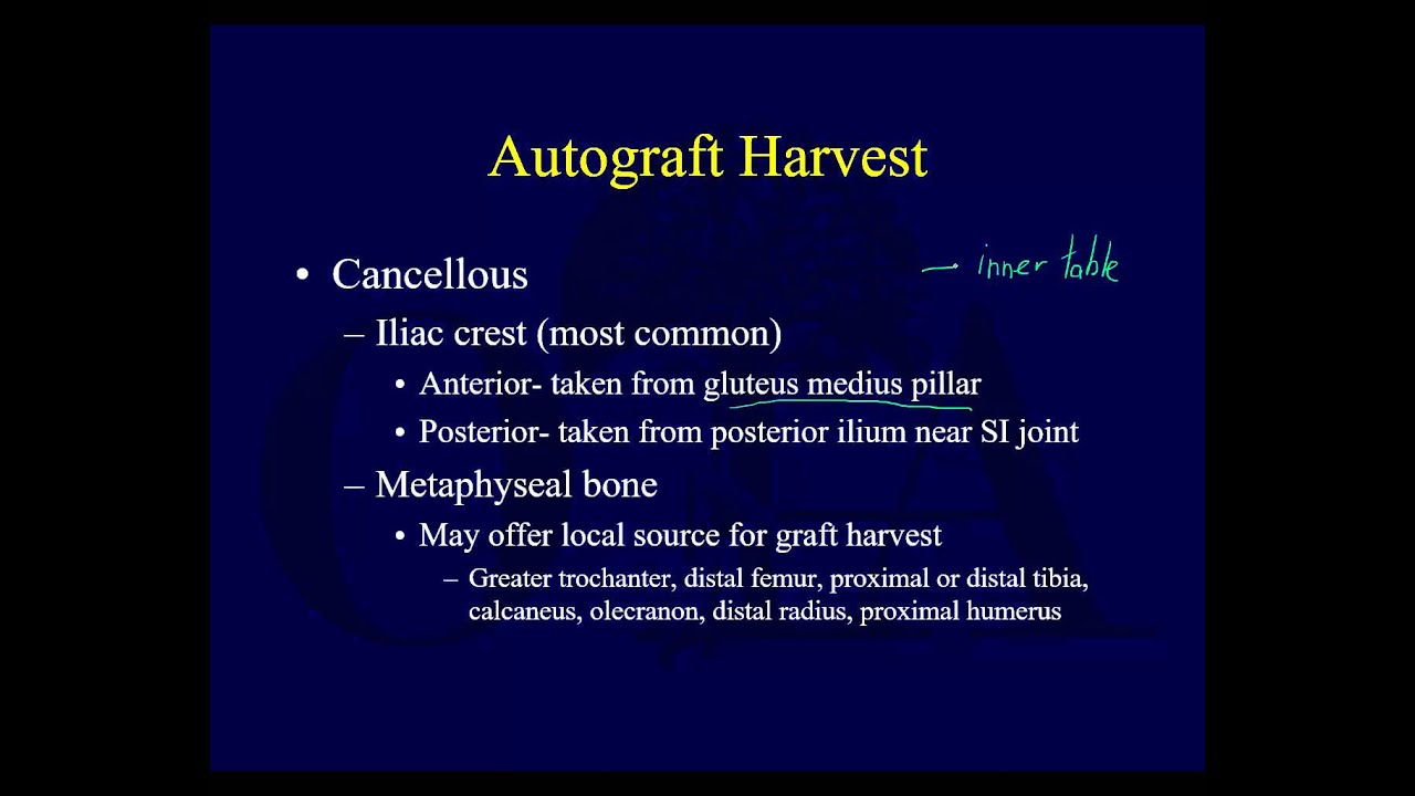 Bone grafting 1 - Autografts and allografts (OTA lecture series III g12c)