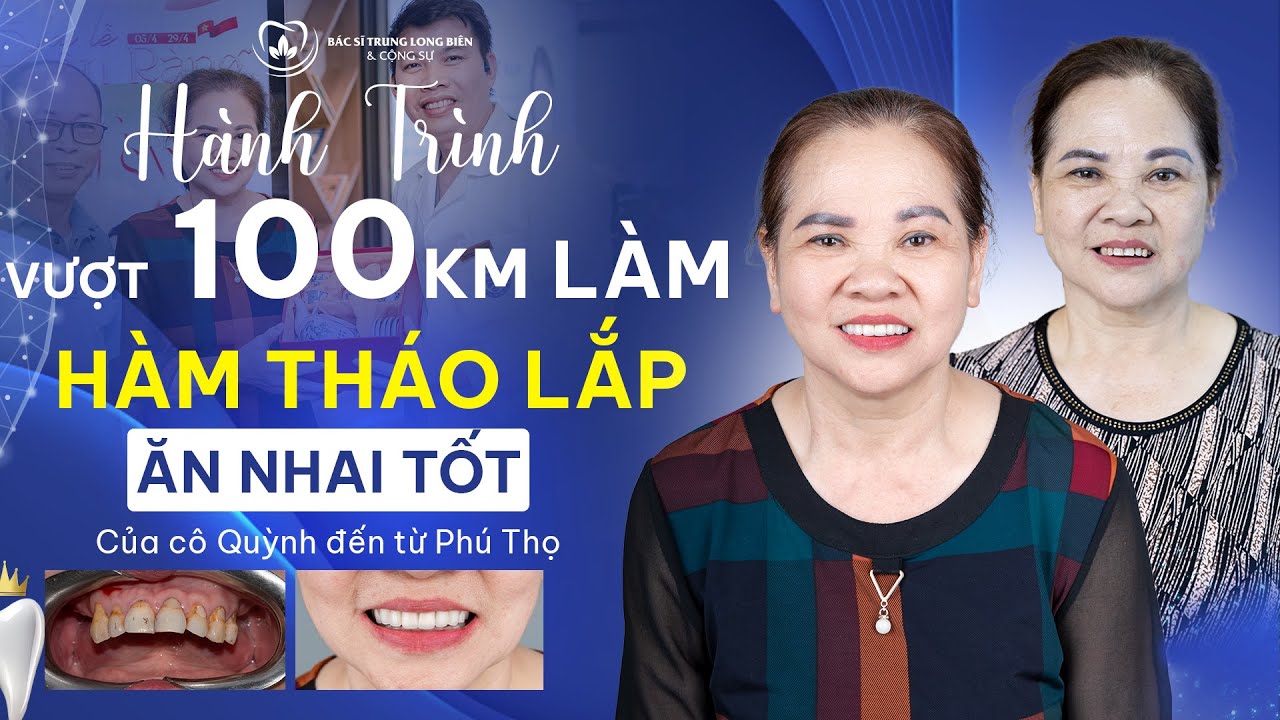 Hành Trình Vượt 100KM Làm Răng Tháo Lắp Ăn Nhai Tốt Của Cô Quỳnh Tại Nha Khoa Bác sĩ Trung Long Biên