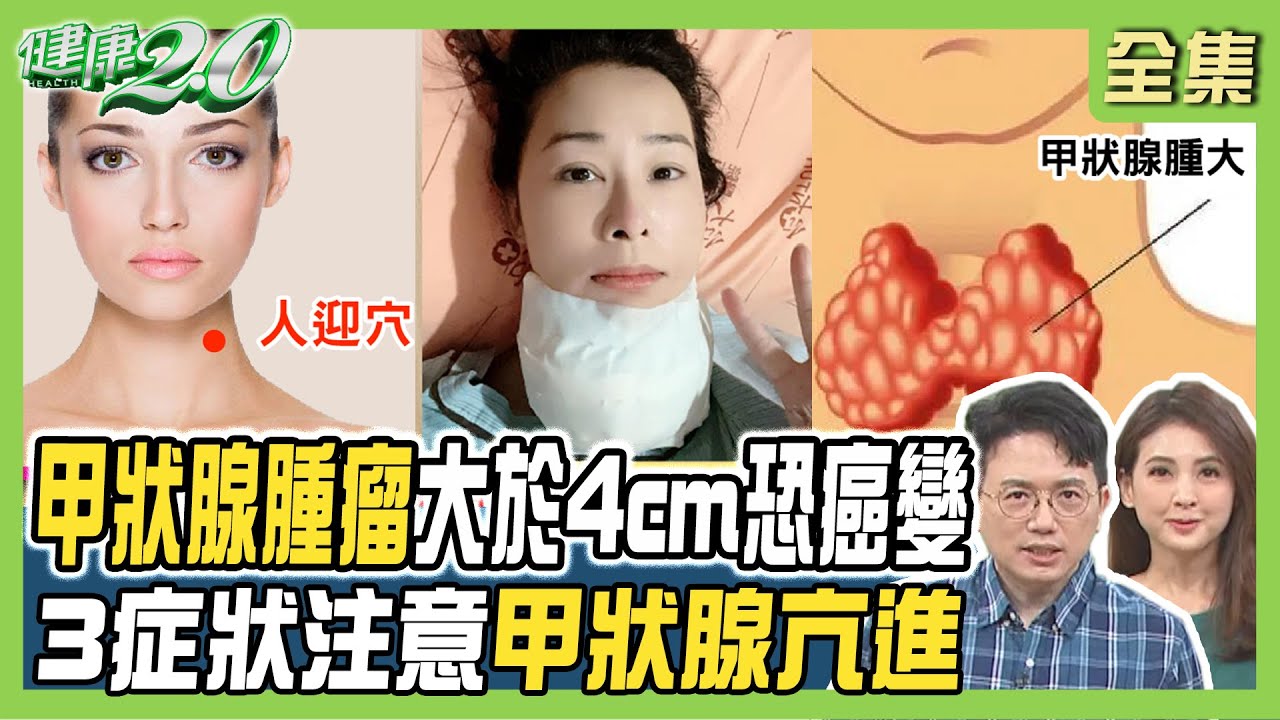 兵家綺罹癌切除甲狀腺 淋巴又有癌！甲亢練肝膽相照式 甲低練任脈調息式氣功！ 健康2.0 20240113【完整版】江坤俊 韋汝 鄭凱倫 陳欣湄 陳潮宗 彥寬 陳之穎 @tvbshealth20
