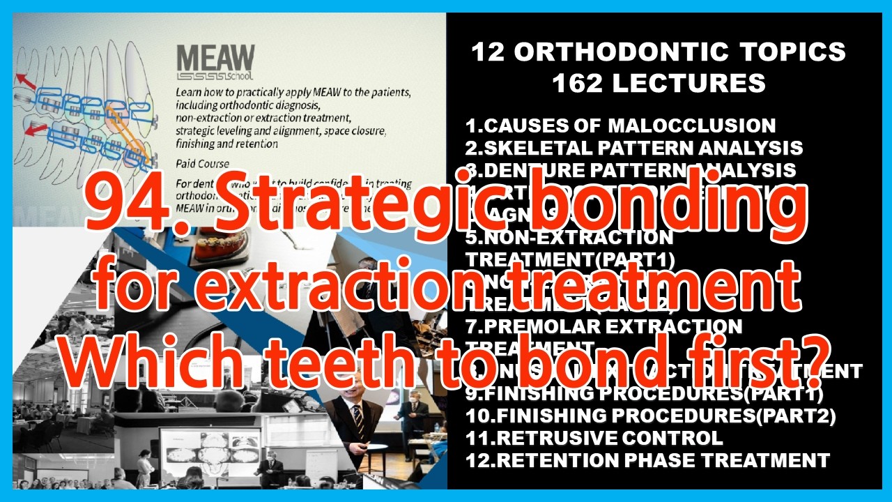94.Strategic bonding for extraction treatment - Which teeth to bond first?