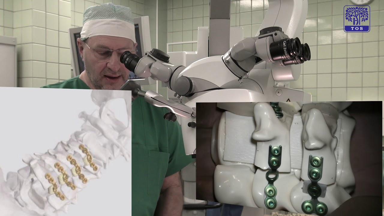 Dr.  Gibners. Kā notiek saspiestu mugurkaula nervu ārstēšana un kanāla paplašināšana