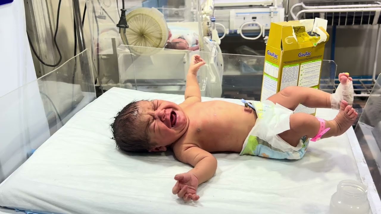 Feeding Movement Day 2 | Baby Now Better & Improving Feeding in NICU