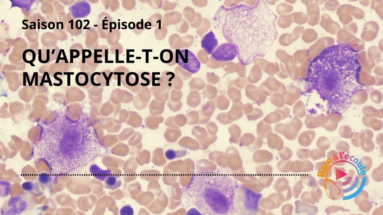 Maladie rare – Qu'appelle-t-on mastocytose ?