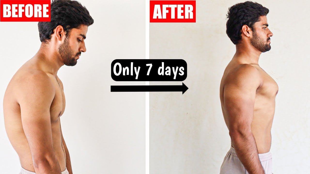 FIX ROUNDED SHOULDERS IN 1 WEEK | Fix Rounded Posture | ( 10 min/daily )