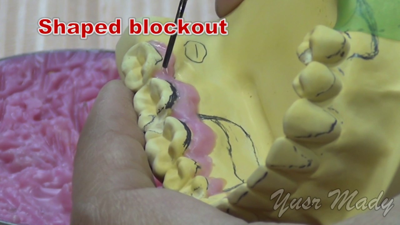 4- Blockout Of Master Casts
