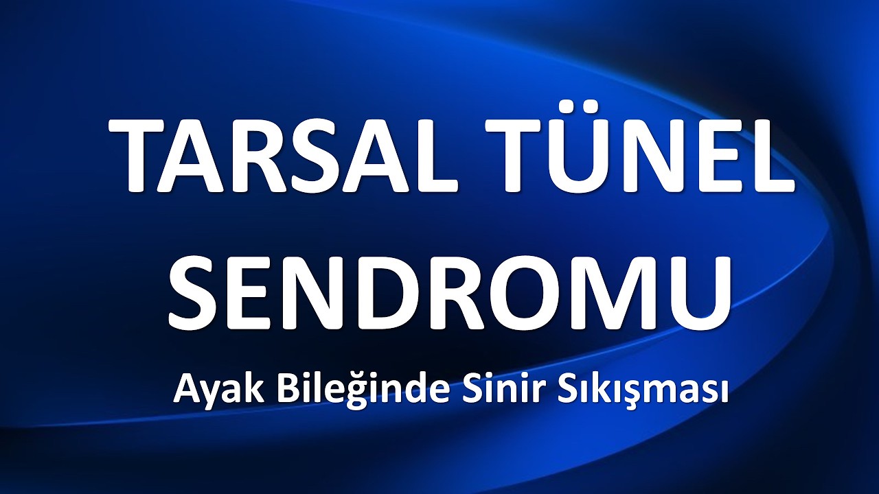 TARSAL TÜNEL SENDROMU Ayakta Sinir Sıkışması