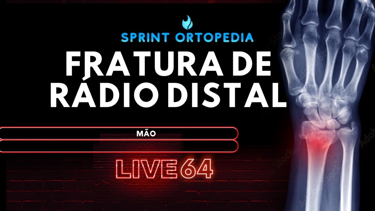 LIVE 64- FRATURA DE RÁDIO DISTAL