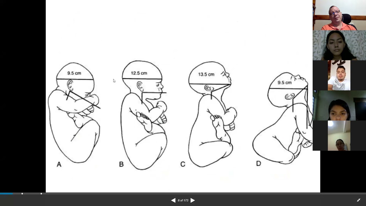 Variedad de presentación fetal