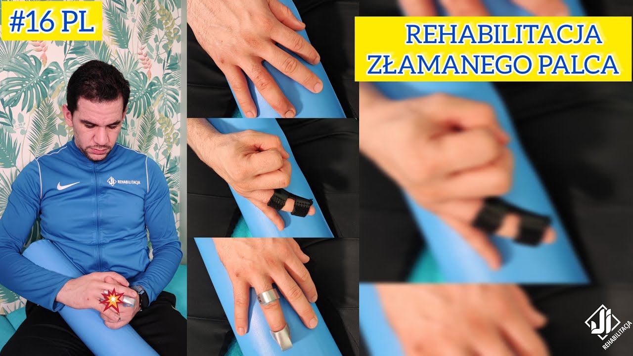 REHABILITACJA ZLAMANEGO PALCA - @J.I. REHABILITACJA