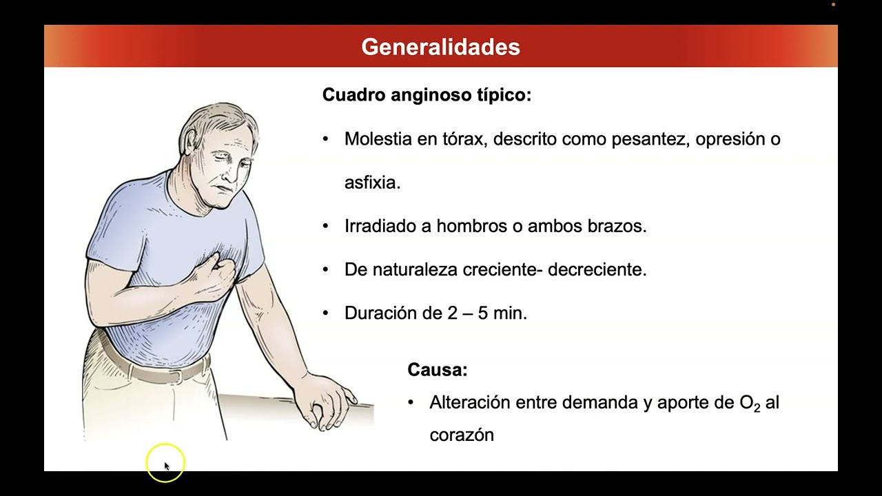 Fármacos antianginosos