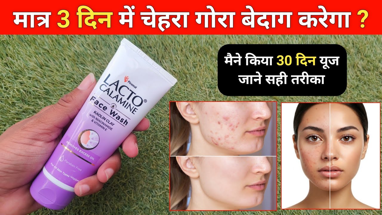 Lacto calamine face wash | beat face wash | lacto calamine face wash review 