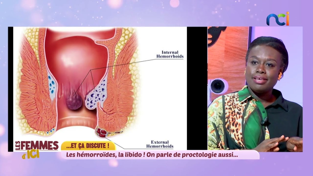 Hémorroïdes - symptômes et causes : on en parle dans Les Femmes d'Ici