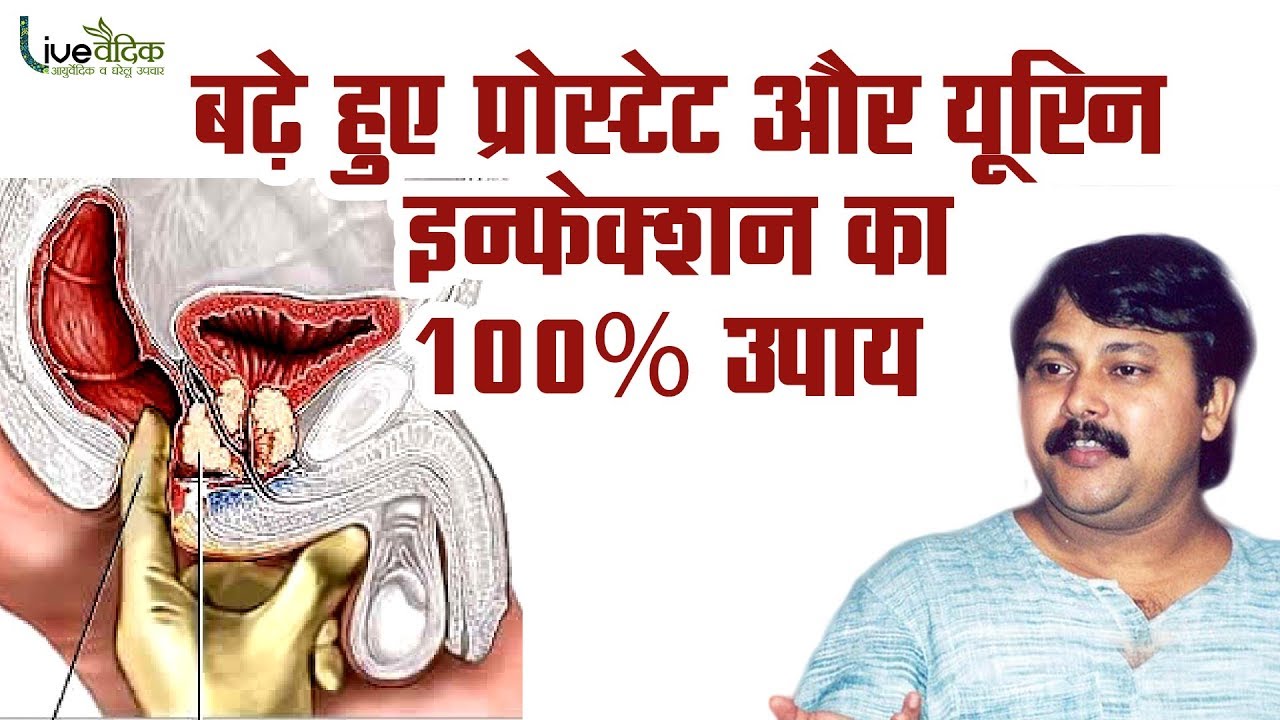 Rajiv Dixit - बढ़े हुए प्रोस्टेट और यूरिन इन्फेक्शन का 100% उपाय | Treatment of Prostate Enlargement