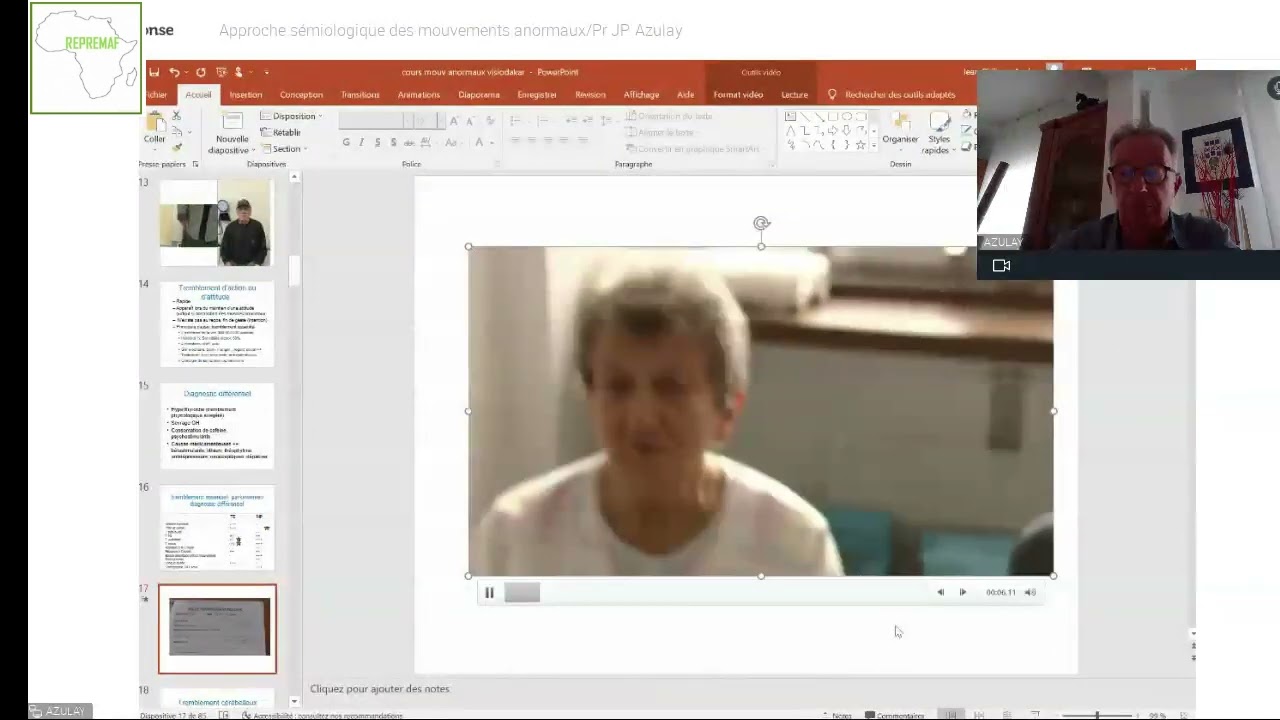 Webinaire/ REPREMAF Approche sémiologique des mouvements anormaux (Pr Jean Phillip Azulay)