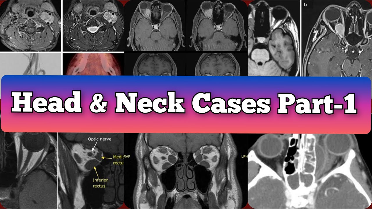 Radiology Viva Cases # 367- 375 | Head and Neck Exam Cases Part -1 #medical #radiology