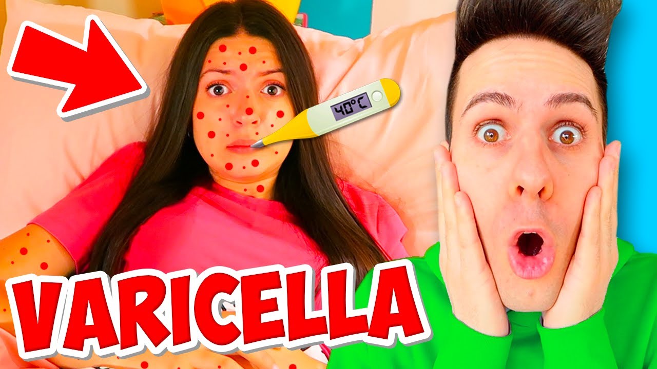 Sofì ha la varicella e sta male...