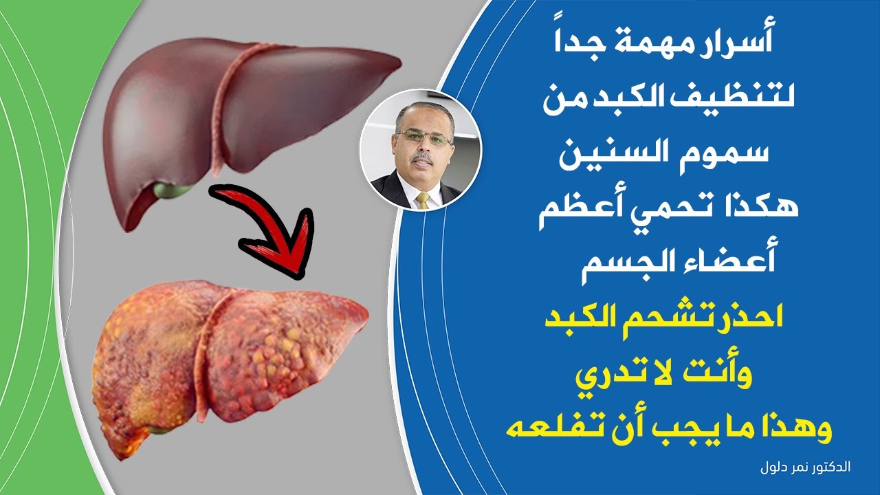 تنظيف الكبد من السموم والدهون وكل ما يجب معرفته عن حيوية ونشاط الكبد ومعلومات مهمة عن التهاب الكبد ؟