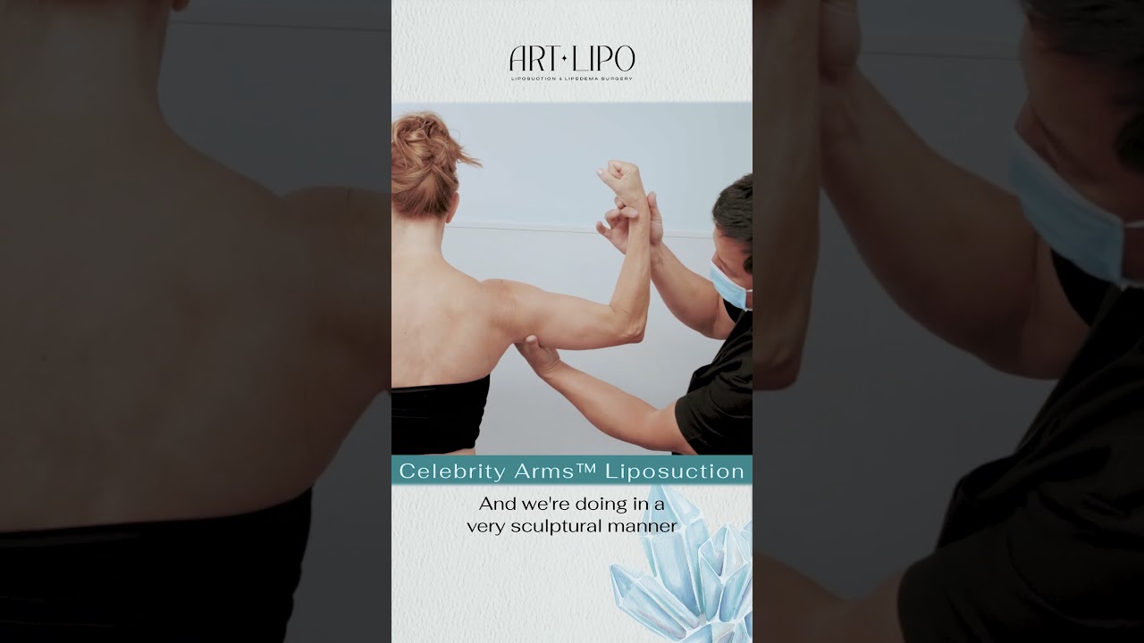 Celebrity Arms&trade; LIPOSUCTION | Immediate Results | Expert Dr. Thomas Su