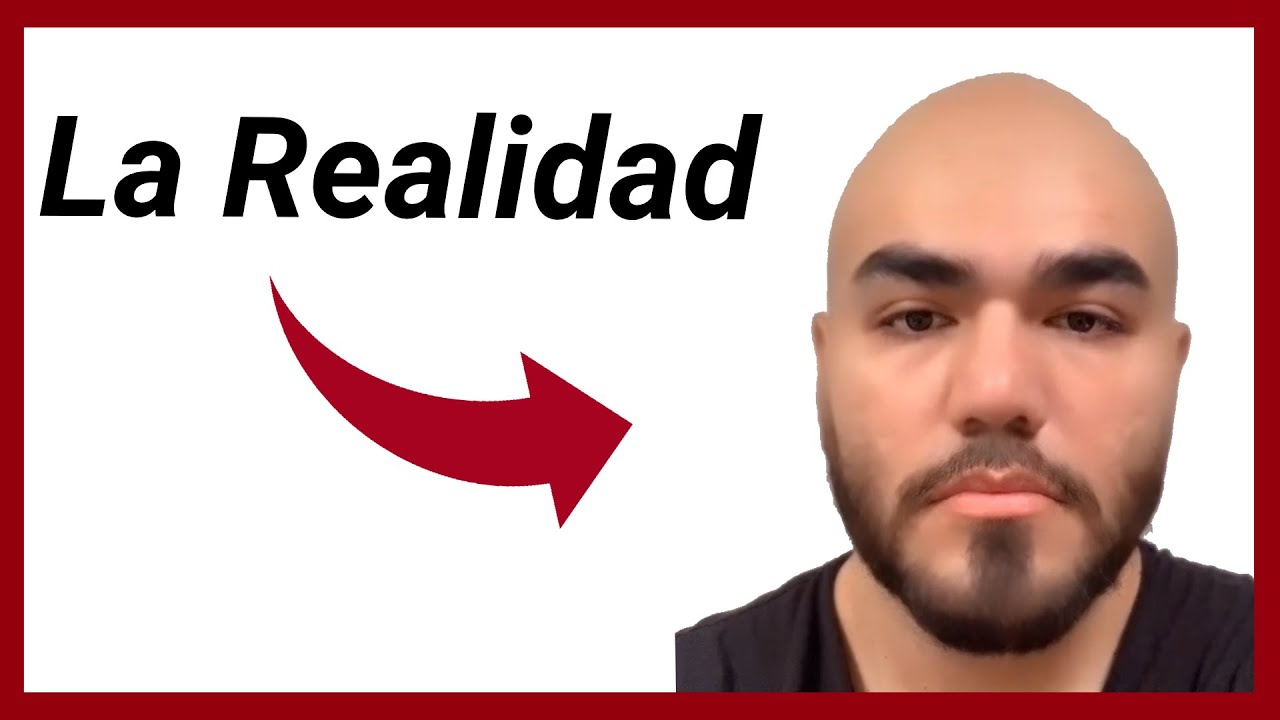 10 VERDADES sobre la Calvicie en los Hombres 😪 ¿A las Mujeres les IMPORTA? 🤔