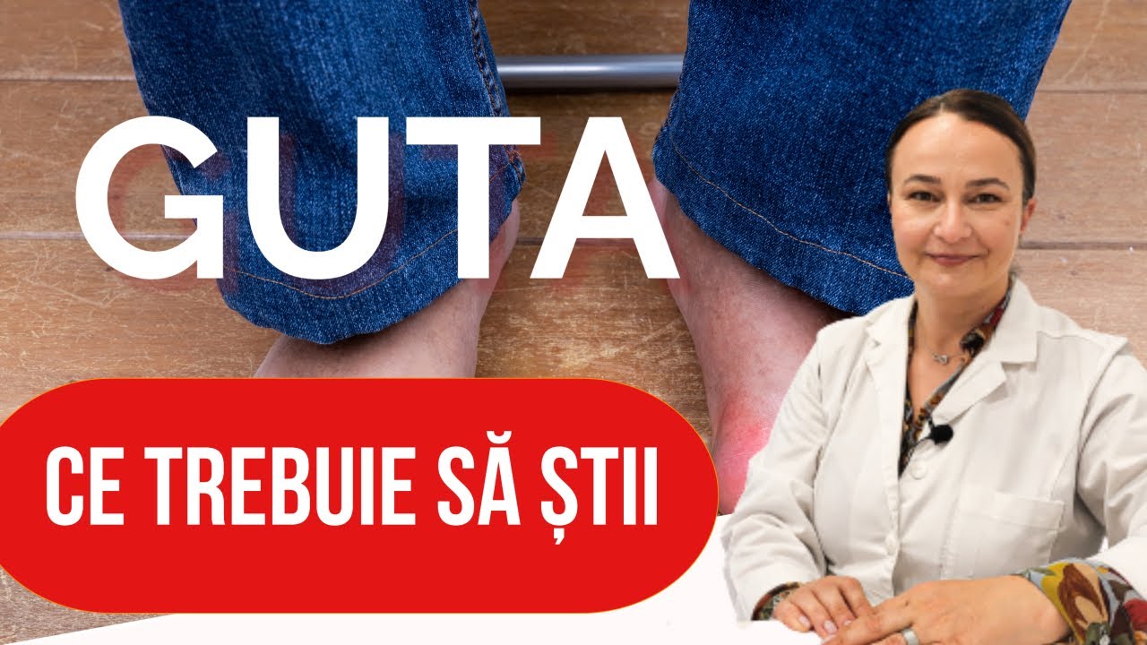 Guta. Ce legătură are cu consumul de carne și ce trebuie să faci