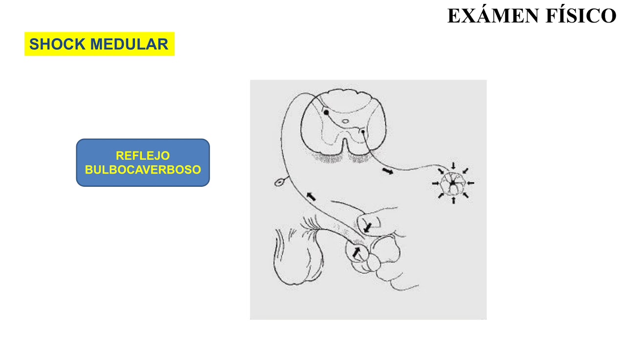 Trauma Raquimedular II