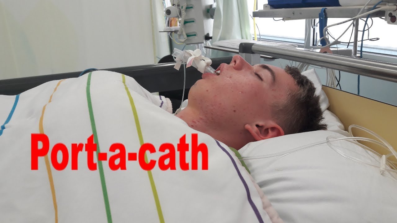 Operatie port-a-cath.
