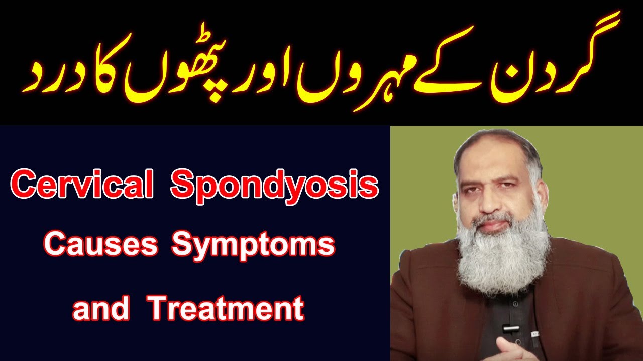 Cervical Spondylosis Treatment | Neck Pain Treatment in Urdu | Gardan Ke Dard  aur Pathon ka ilaj