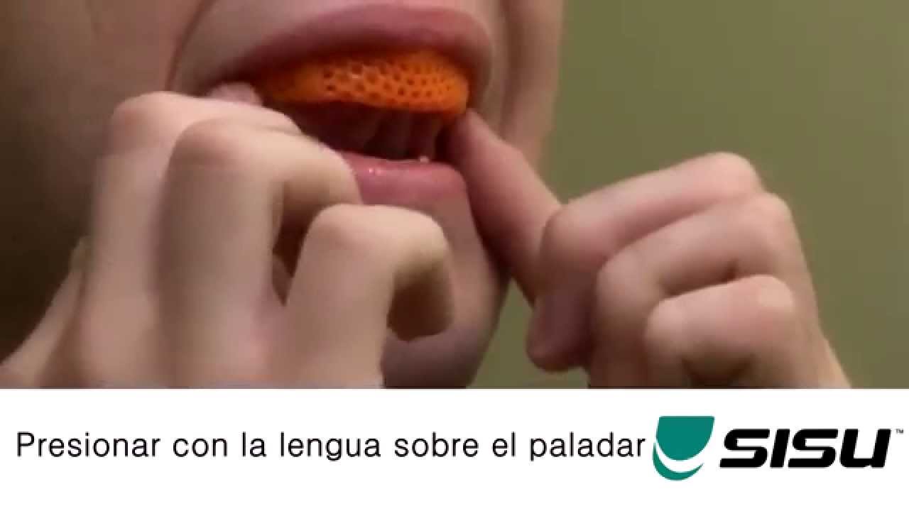 C&oacute;mo adaptar a tu boca el protector bucal SISU