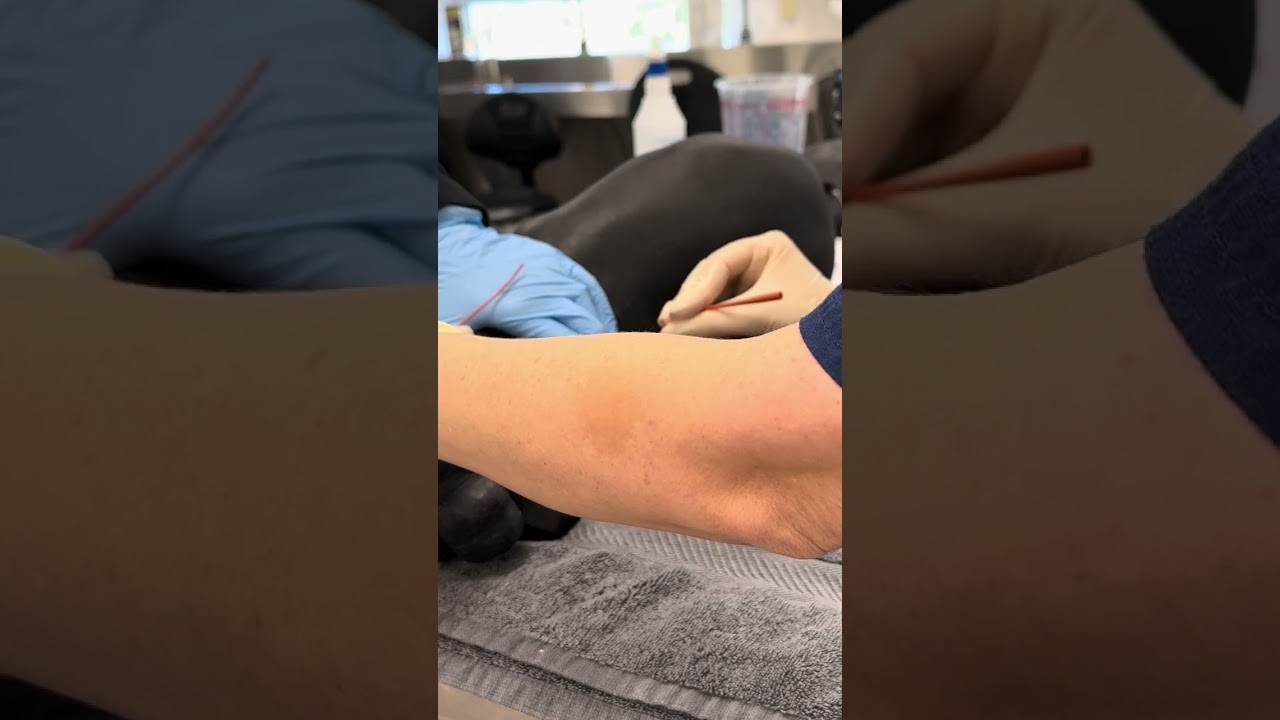 Male dog urinary catheter technique