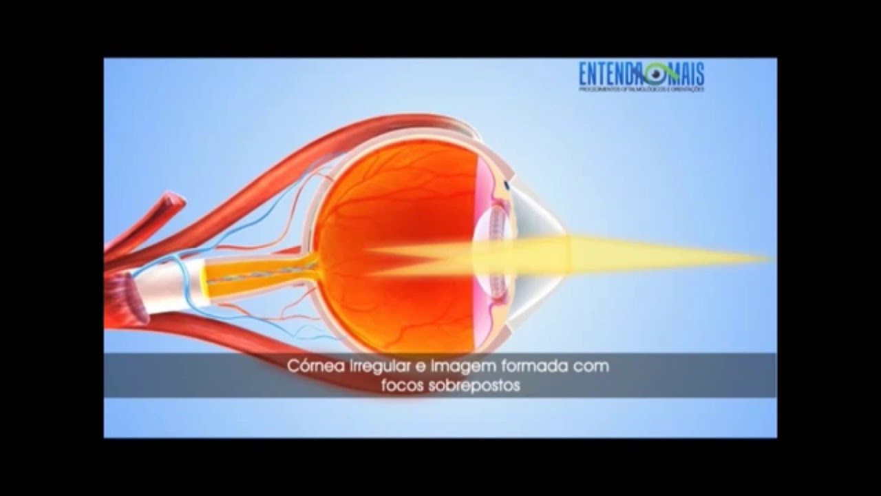 Entenda mais sobre a refração